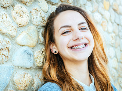 First-Week-of-Braces