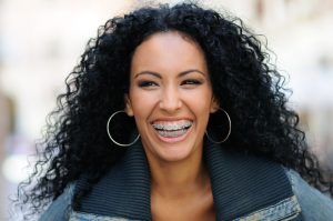 Adult Orthodontics Miami FL